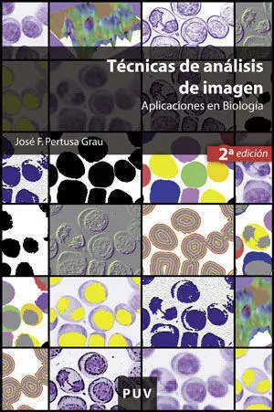Técnicas de Análisis de Imagen, (2A Ed. )