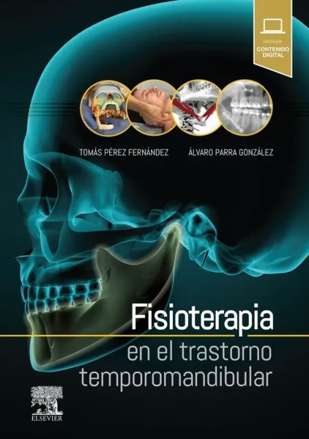 Fisioterapia en el Trastorno Temporomandibular