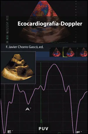 Ecocardiografía-Doppler